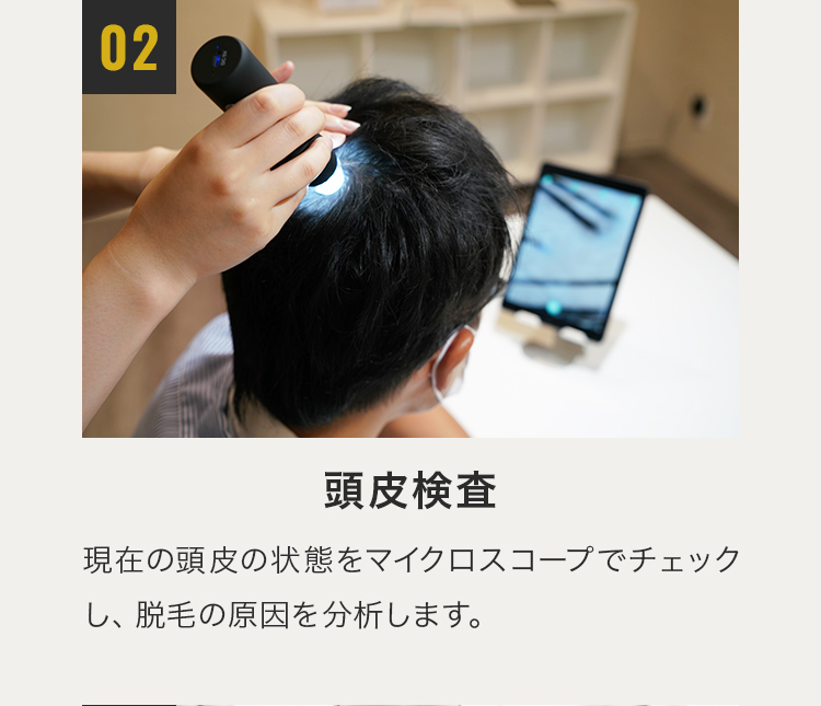 2.頭皮検査：現在の頭皮の状態をマイクロスコープでチェックし、脱毛の原因を分析します。